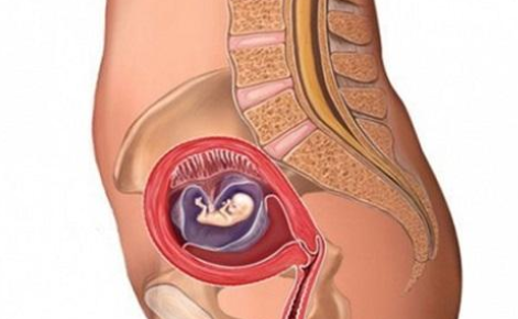 宮頸妊娠藥物怎么治療 宮頸妊娠是大手術嗎