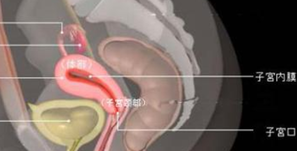 宮頸妊娠藥物怎么治療 宮頸妊娠是大手術(shù)嗎