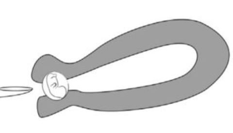 宮頸妊娠的發生原因 宮頸妊娠和流產過有關嗎