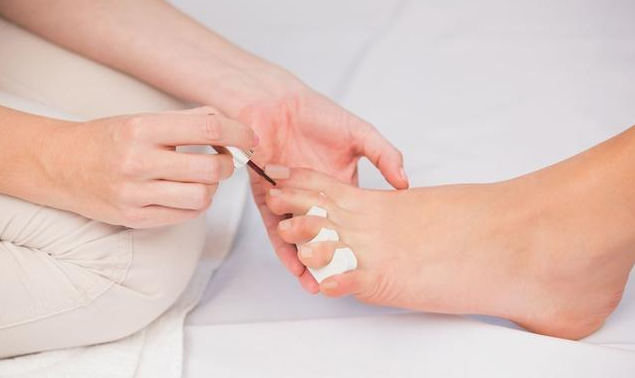 用醋泡腳可以治腳氣嗎 腳氣的不同類型及治療方法