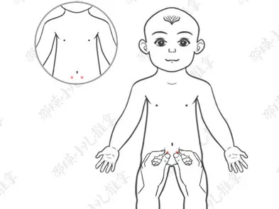 孩子小兒疳癥怎么治療 如何用推拿手法治療小兒疳癥