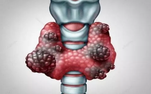 甲狀腺懷孕影響胎兒嗎 甲狀腺懷孕孩子能不能要 甲狀腺懷孕影響胎兒嗎 甲狀腺懷孕孩子能不能要
