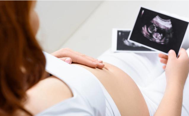 四維彩超寶寶為什么愛捂臉 四維彩超檢查應該看哪些指標