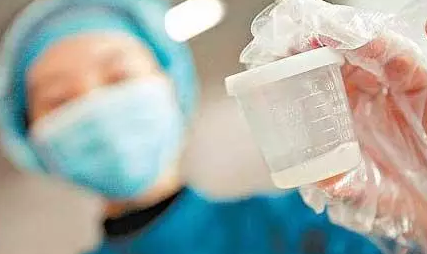 冷凍精子是怎樣的 凍精會影響試管成功率嗎