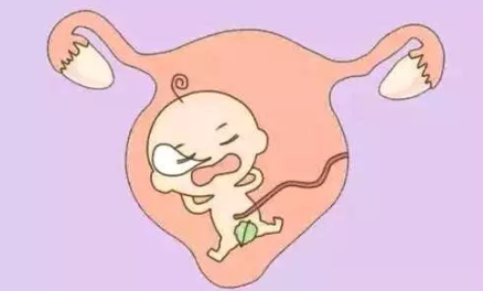 幼稚子宮是什么意思 幼稚子宮是怎么形成的 幼稚子宮是什么意思 幼稚子宮是怎么形成的