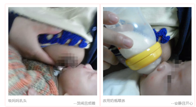 寶寶有乳頭錯覺是怎么回事 寶寶乳頭錯覺還能糾正過來嗎