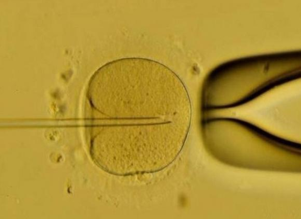 試管嬰兒取卵后肚子不舒服是什么原因 反復取卵對卵巢有影響嗎 試管嬰兒取卵后肚子不舒服是什么原因 反復取卵對卵巢有影響嗎