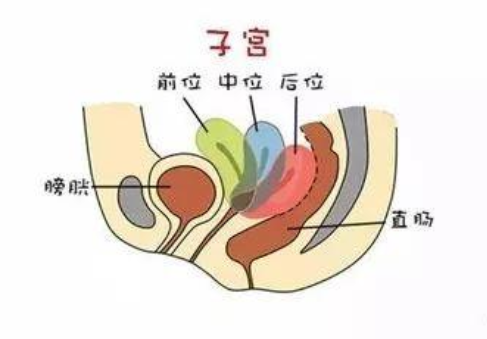 子宮偏小還能懷孕嗎 子宮偏小懷孕的幾率就小嗎 子宮偏小還能懷孕嗎 子宮偏小懷孕的幾率就小嗎