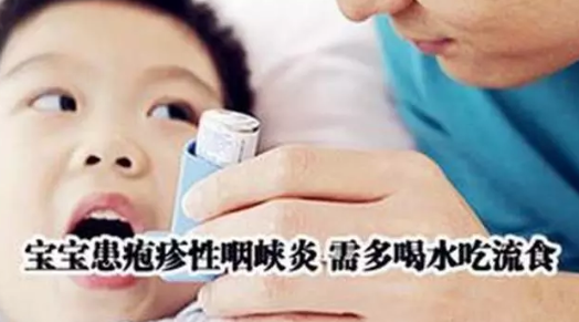 寶寶皰疹性咽峽炎和手足口病區別 如何預防小兒皰疹性咽峽炎