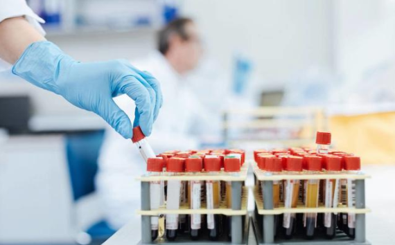 糖尿病是藥物治療好還是手術(shù)效果好 糖尿病人要做哪些檢查項目