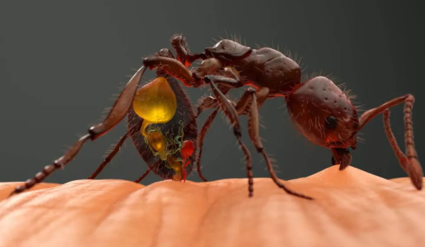 孩子被螞蟻咬了腫很大可以刺破嗎 螞蟻咬了多久好