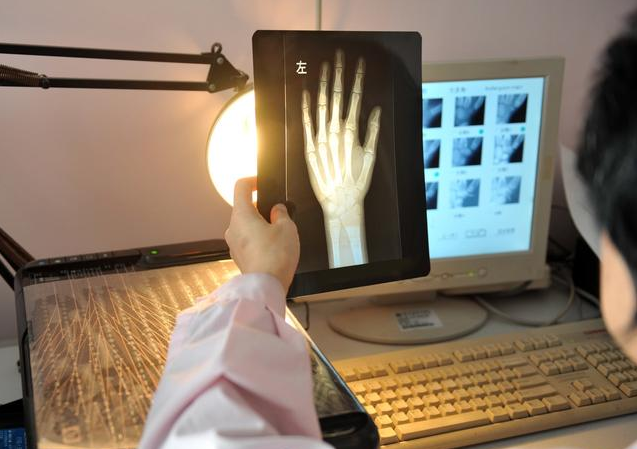 骨齡和實際年齡差多少是異常的 骨齡多少歲就不長高了