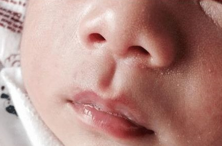 寶寶吐泡泡是怎么回事 寶寶吐泡泡就是肺炎嗎