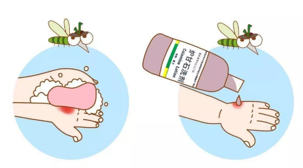 不同年齡段怎么給孩子驅(qū)蚊 孩子被蚊子咬了怎么幫他止癢