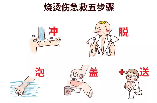 孩子突發(fā)被燙傷怎么辦 夏季孩子被燙傷正確處理方法