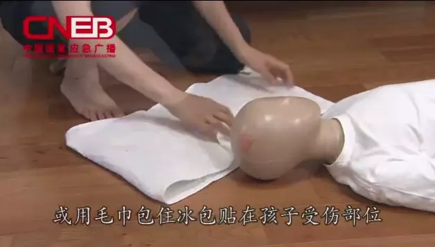 孩子被燙傷具體急救方法 孩子被燙傷部位怎么處理比較好