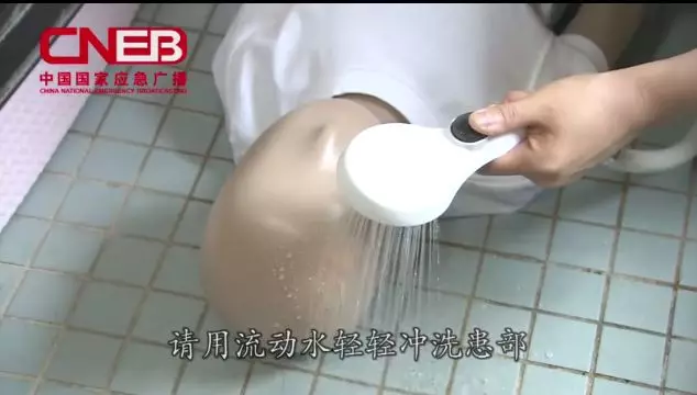 孩子被燙傷具體急救方法 孩子被燙傷部位怎么處理比較好