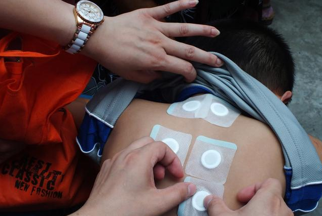 小孩能貼三伏貼嗎 哪些寶寶適宜貼三伏貼