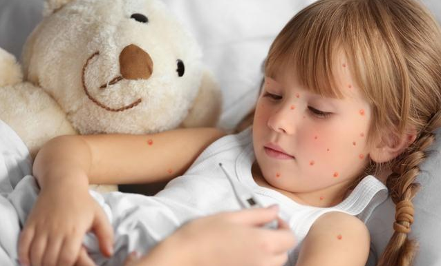 寶寶出水痘怎么快速止癢 出水痘應(yīng)該要注意什么