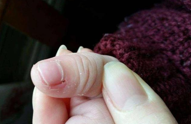 孩子為什么總是啃手指 如何改掉孩子啃手指的習慣