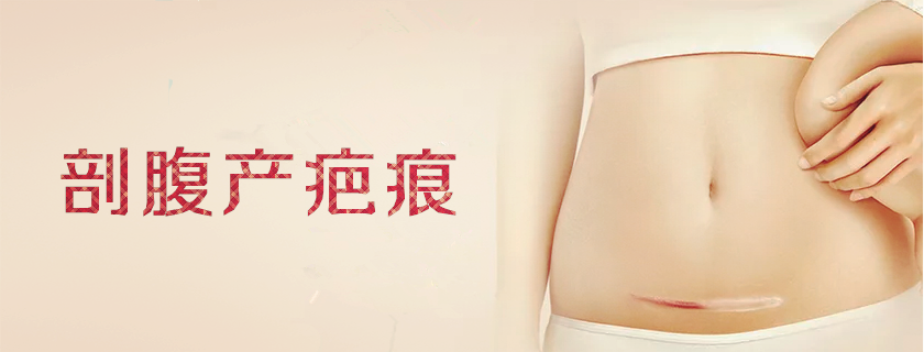 剖腹產疤痕又癢又疼是怎么回事 產后傷口發癢應對方法