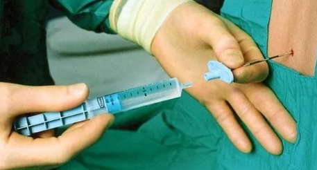 會陰側(cè)切后會有后遺癥嗎 會陰側(cè)切后的護理 會陰側(cè)切后會有后遺癥嗎 會陰側(cè)切后的護理