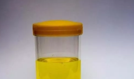 漏尿和破水怎么區(qū)分 懷孕32周漏尿和破水有什么區(qū)別