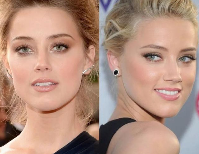 頸紋深怎么辦 怎么淡化頸紋