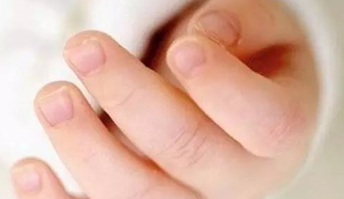 寶寶指甲凹凸不平是什么原因 寶寶指甲凹凸不平怎么辦