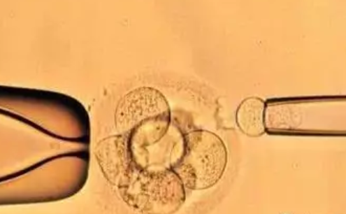 吃了促排藥物小腹脹痛正常嗎 促排小腹脹痛是卵泡在長大嗎