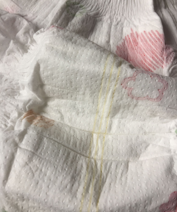 優樹纖薄呼吸紙尿褲悶不悶 優樹纖薄呼吸紙尿褲孩子用了會紅屁屁嗎