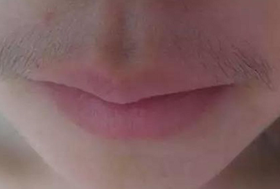 女生為什么會長胡子 女生長胡子怎么解決 女生為什么會長胡子 女生長胡子怎么解決