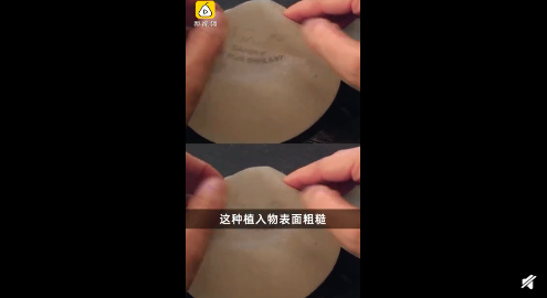 隆胸填充物引發(fā)癌癥召回是怎么回事 假體隆胸材料有哪些