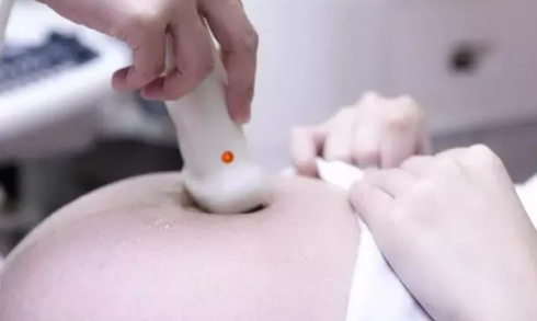 備孕期能拍胸片嗎 備孕期拍胸片對寶寶有影響嗎