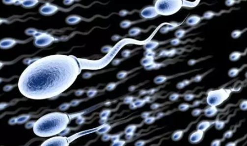 精液有異味要注意什么 正常人的精液是什么顏色