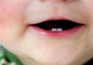 幾歲給寶寶做乳牙護理合適 怎么給寶寶做乳牙護理