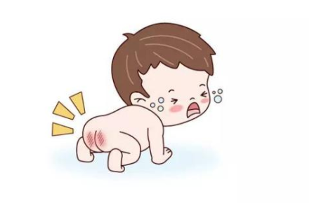 寶寶肛瘺怎么保守治療 寶寶肛瘺治療偏方