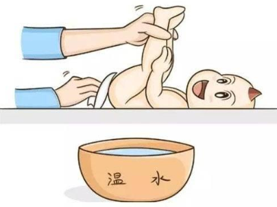 寶寶肛瘺怎么保守治療 寶寶肛瘺治療偏方