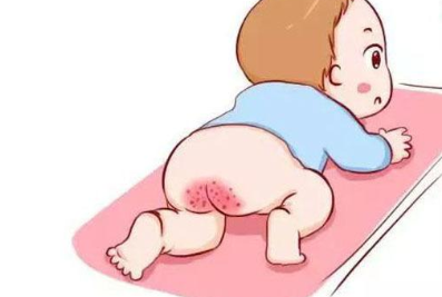 寶寶肛瘺是怎么引起的 寶寶肛瘺是不是嚴(yán)重的疾病