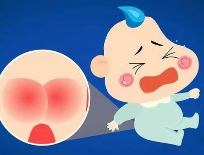 寶寶肛瘺是怎么引起的 寶寶肛瘺是不是嚴(yán)重的疾病