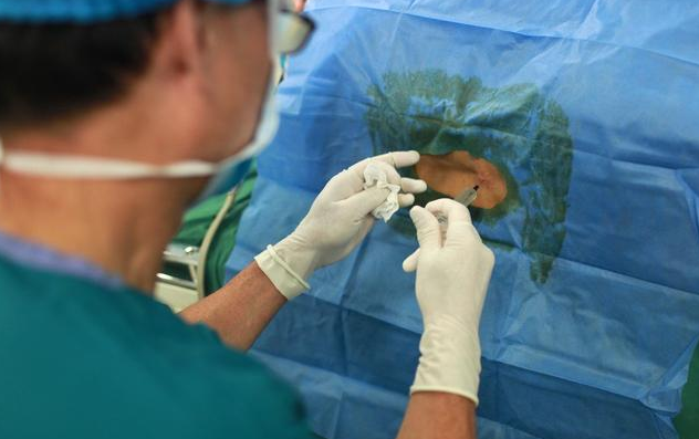 剖宮產腰麻怎么操作 剖宮產腰麻有沒有危險 剖宮產腰麻怎么操作 剖宮產腰麻有沒有危險