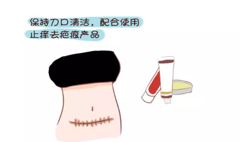 剖腹產(chǎn)怎么防止疤痕增生 防止剖腹產(chǎn)疤痕增生吃什么