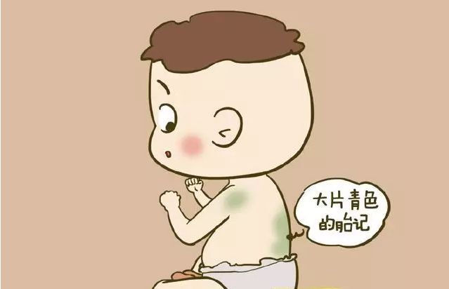 寶寶胎記有什么說法 如何正確看待寶寶胎記