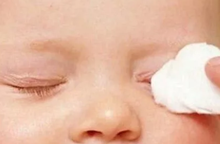 夏天寶寶上火眼屎多怎么辦 寶寶夏天眼屎多的原因有哪些