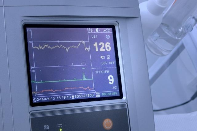 胎心率低于140是生男孩嗎 胎心率看男女準確嗎