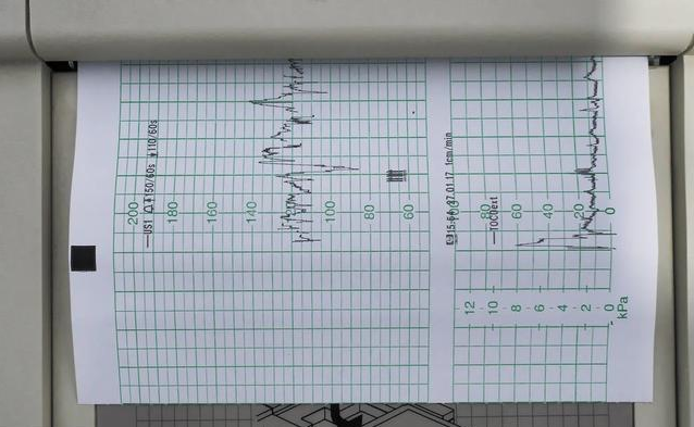 胎心率低于140是生男孩嗎 胎心率看男女準確嗎