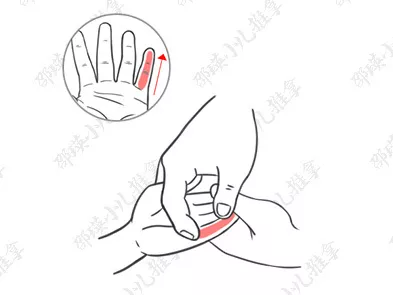 怎么判斷孩子蕁麻疹的類型 孩子蕁麻疹怎么推拿