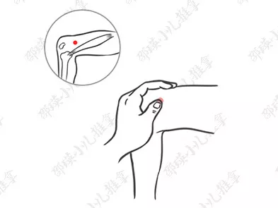 怎么判斷孩子蕁麻疹的類型 孩子蕁麻疹怎么推拿