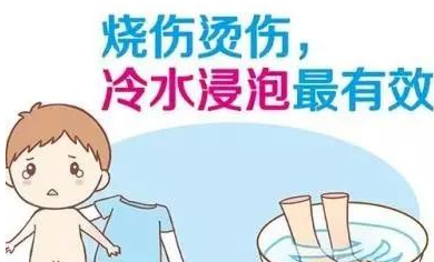 孩子燙傷了怎么辦 孩子燙傷了應該怎么處理 孩子燙傷了怎么辦 孩子燙傷了應該怎么處理