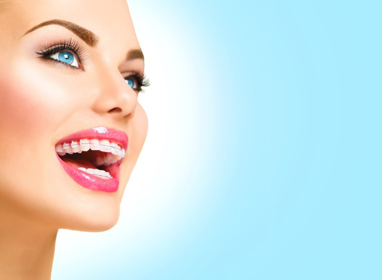 帶牙套的心情說說 帶上牙套后的心情感慨